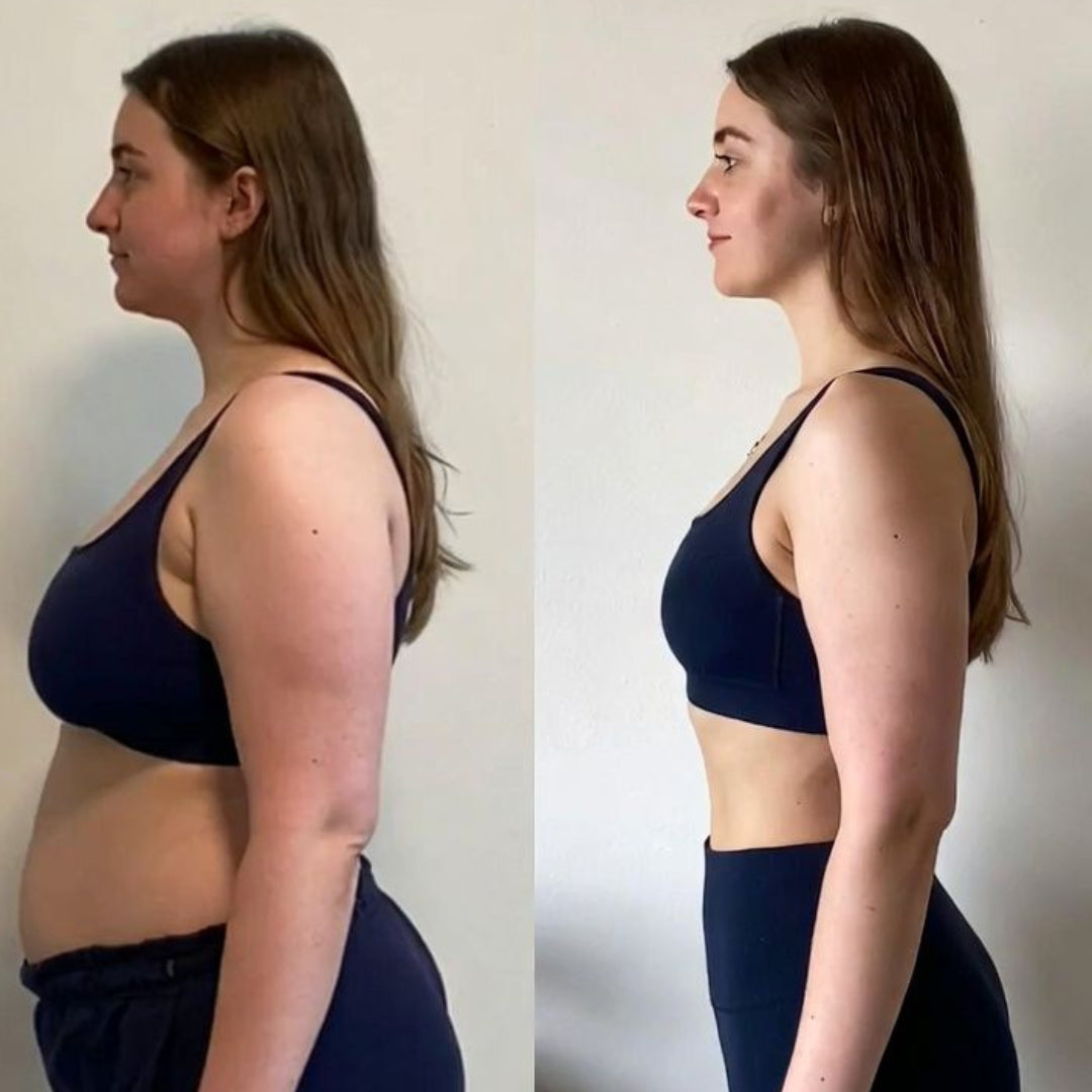 Transformaci&oacute;n Sof&iacute;a - Antes y Despu&eacute;s