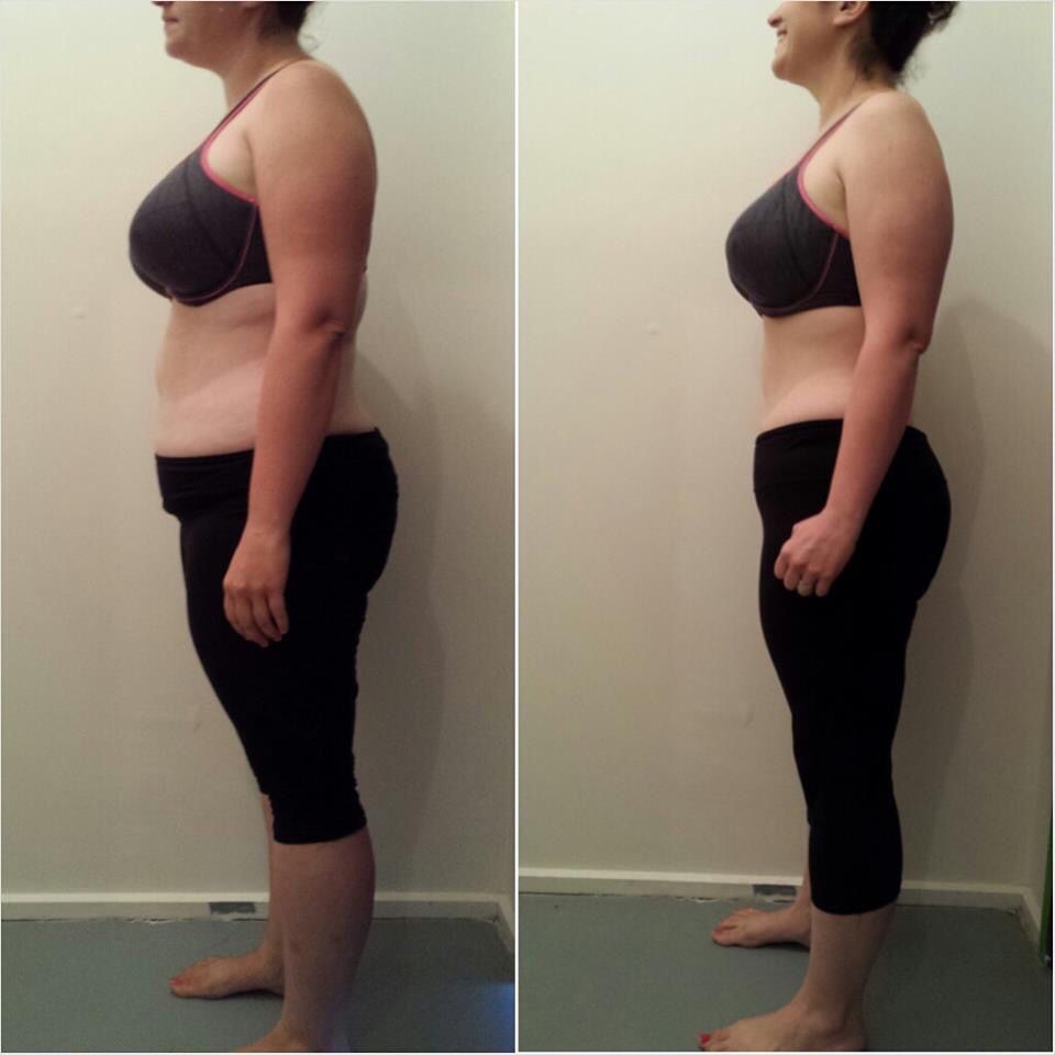 Transformaci&oacute;n Agustina - Antes y Despu&eacute;s